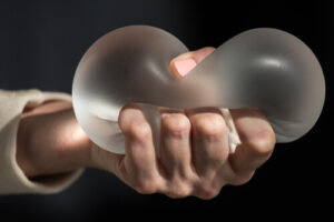 what do breast implants look like when you're old pressure bondi junction